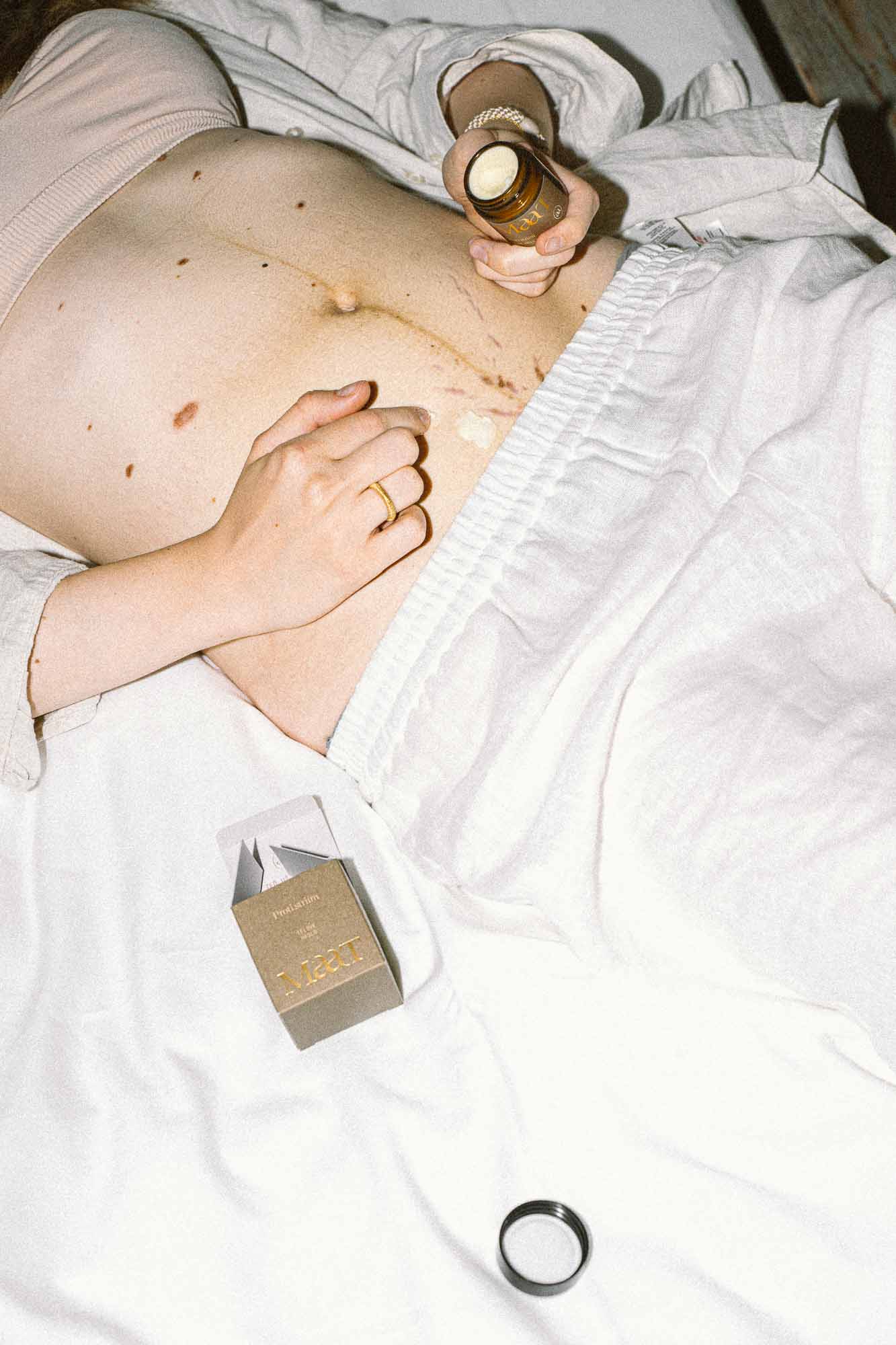 Tělové máslo Proti striím